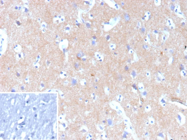 Hexokinase 1 Antibody in Immunohistochemistry (IHC (P))