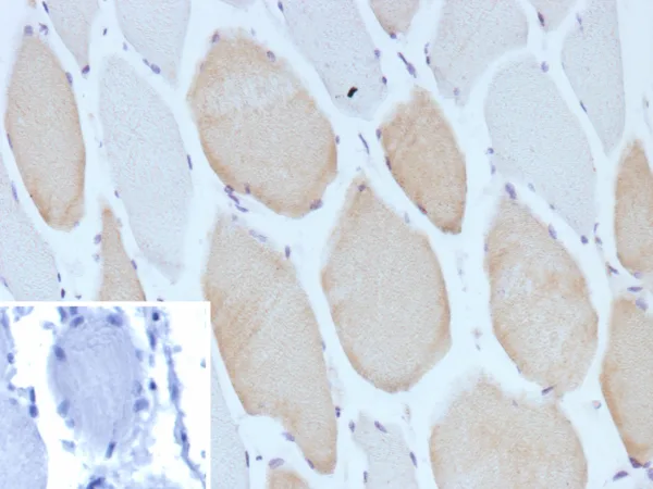 MYH7 Antibody in Immunohistochemistry (IHC (P))