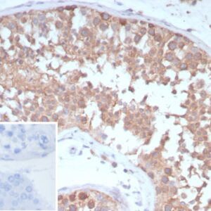 TEK / TIE2 Antibody in Immunohistochemistry (IHC (P))