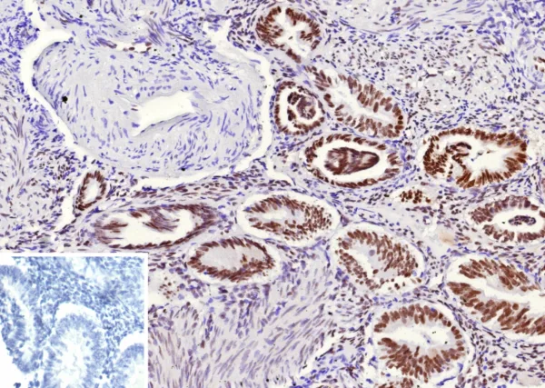 TLE1 Antibody in Immunohistochemistry (IHC (P))