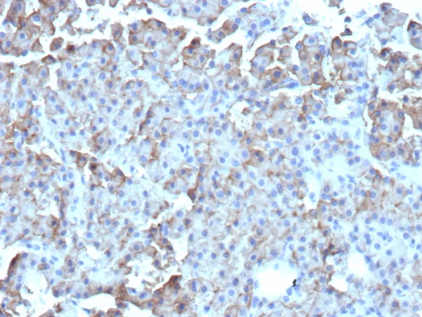 CD109 Antibody in Immunohistochemistry (IHC (P))