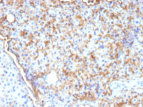 CD109 Antibody in Immunohistochemistry (IHC (P))