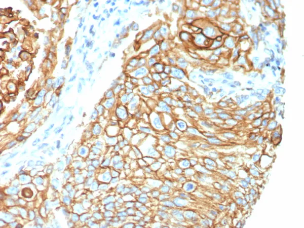 CD142 Antibody in Immunohistochemistry (IHC (P))