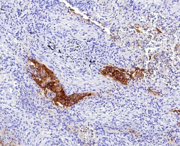 CD142 Antibody in Immunohistochemistry (IHC (P))