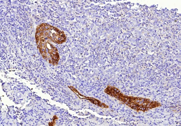 CD142 Antibody in Immunohistochemistry (IHC (P))