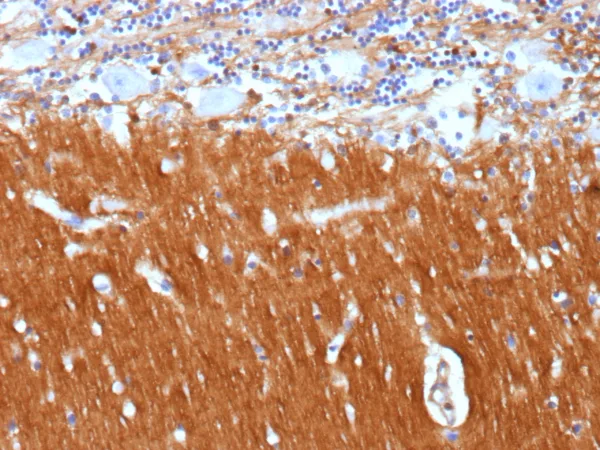 CD171 Antibody in Immunohistochemistry (IHC (P))