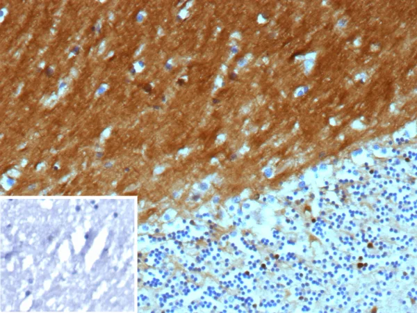 CD171 Antibody in Immunohistochemistry (IHC (P))