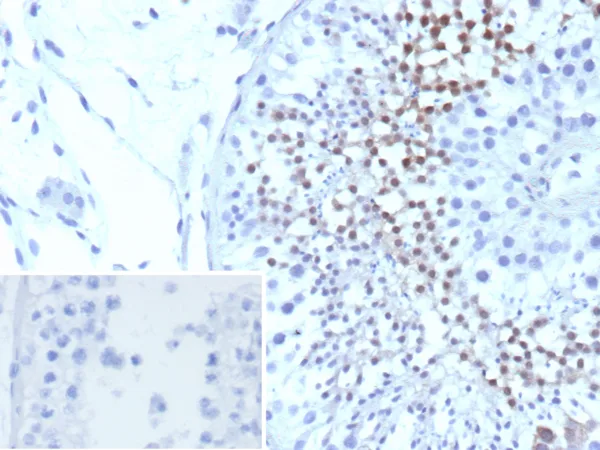 Centrin-1 Antibody in Immunohistochemistry (IHC (P))