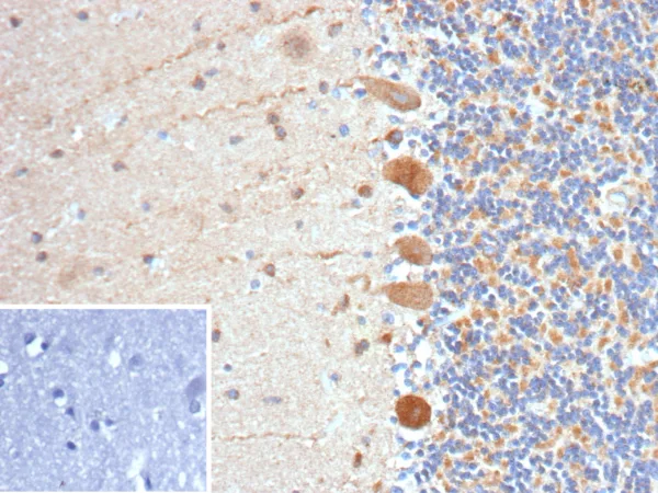 FLT3 Antibody in Immunohistochemistry (IHC (P))