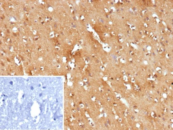 FLT3 Antibody in Immunohistochemistry (IHC (P))