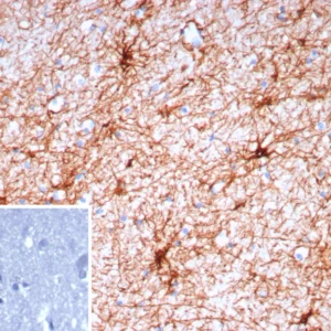 GFAP Antibody in Immunohistochemistry (IHC (P))