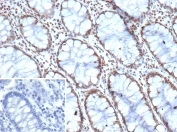 HES5 Antibody in Immunohistochemistry (IHC (P))