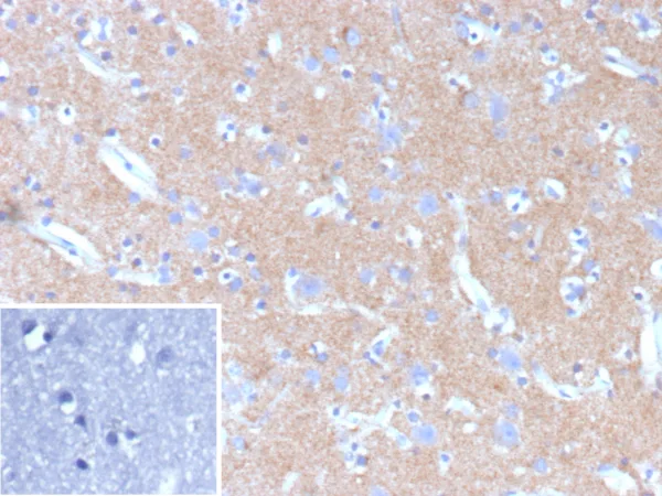 Hexokinase 1 Antibody in Immunohistochemistry (IHC (P))