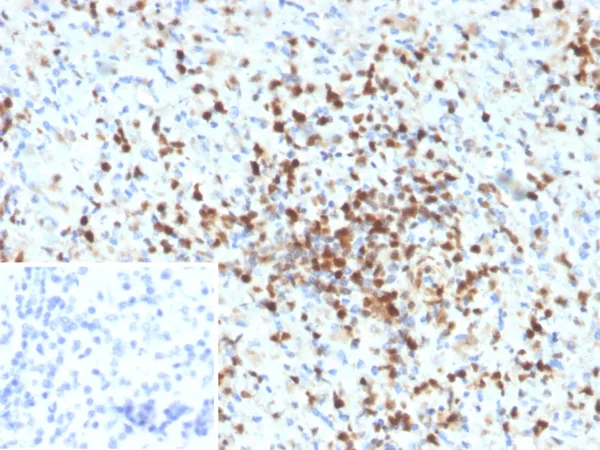 S100A4 Antibody in Immunohistochemistry (IHC (P))