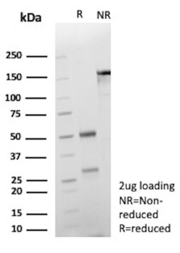 Cadherin 17 Antibody in SDS-PAGE