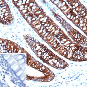 Cadherin 17 Antibody in Immunohistochemistry (IHC (P))