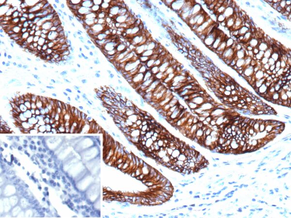 Cadherin 17 Antibody in Immunohistochemistry (IHC (P))