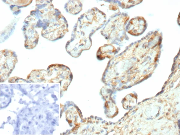 Galectin-3 Antibody in Immunohistochemistry (IHC (P))