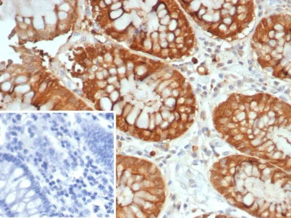 Galectin-3 Antibody in Immunohistochemistry (IHC (P))