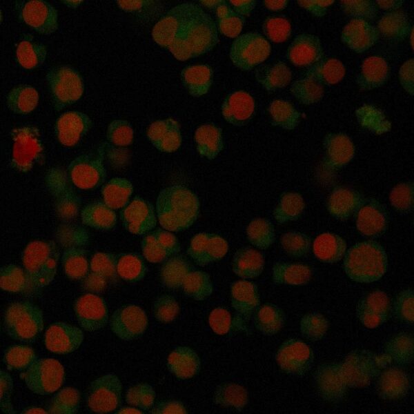 IgA Antibody in Immunofluorescence (IF)