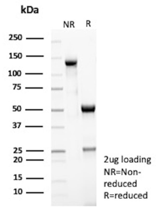 Peroxiredoxin 4 Antibody in SDS-PAGE