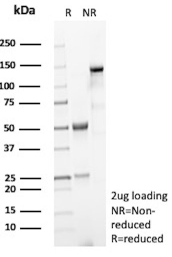 PLA2R1 Antibody in SDS-PAGE