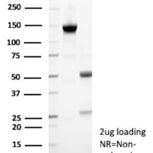 TFPI2 Antibody in SDS-PAGE