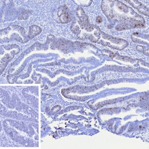 MCM4 Antibody in Immunohistochemistry (IHC (P))