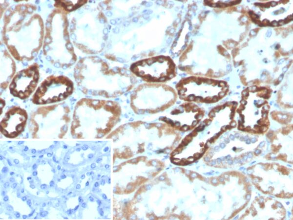 PLA2R1 Antibody in Immunohistochemistry (IHC (P))