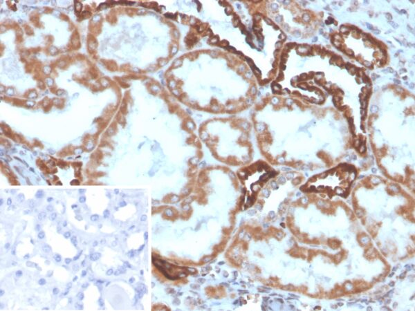 PLA2R1 Antibody in Immunohistochemistry (IHC (P))