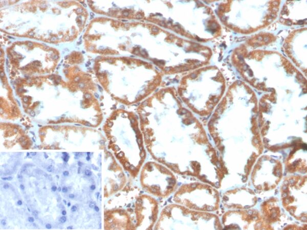 PLA2R1 Antibody in Immunohistochemistry (IHC (P))