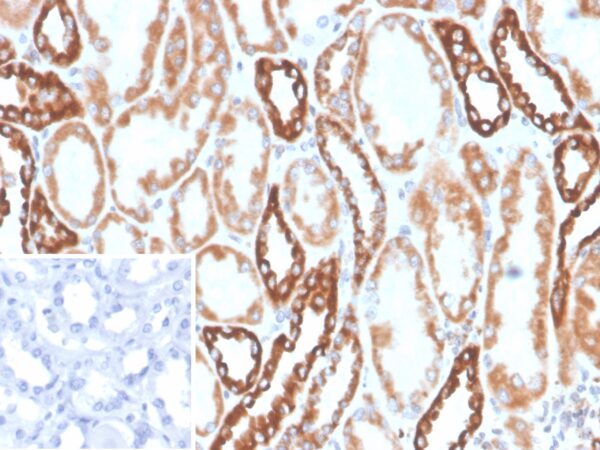 PLA2R1 Antibody in Immunohistochemistry (IHC (P))