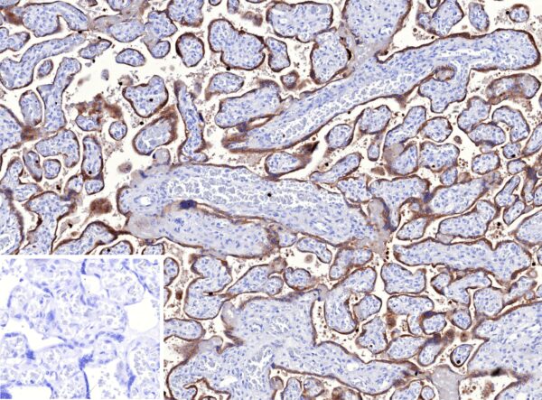 TFPI2 Antibody in Immunohistochemistry (IHC (P))