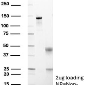 DBC2 / RHOBTB2 Antibody in SDS-PAGE