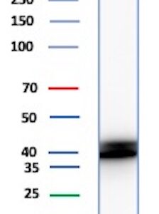 HLA-E Antibody in Western Blot (WB)