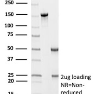 Cyclin D1 Antibody in SDS-PAGE