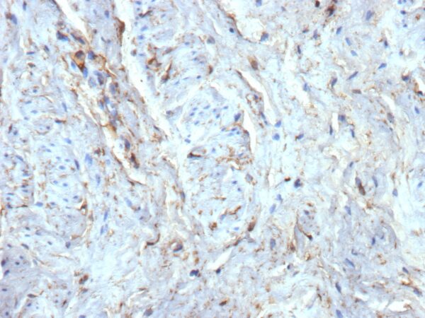 CD34 Antibody in Immunohistochemistry (IHC (P))