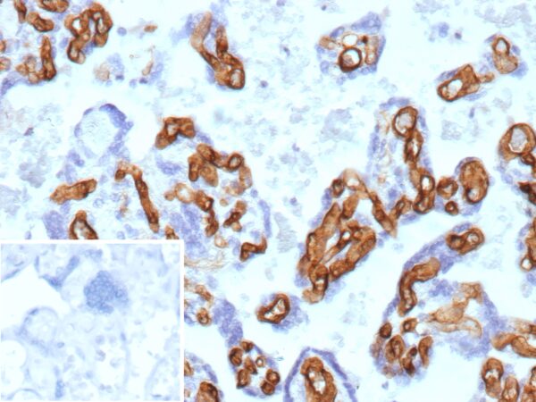 CD34 Antibody in Immunohistochemistry (IHC (P))