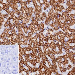 CPS1 Antibody in Immunohistochemistry (IHC (P))