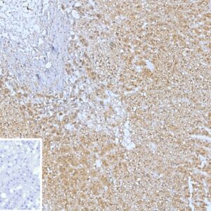 CXCR5 Antibody in Immunohistochemistry (IHC (P))