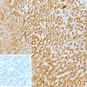 CXCR5 Antibody in Immunohistochemistry (IHC (P))