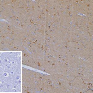 CXCR5 Antibody in Immunohistochemistry (IHC (P))