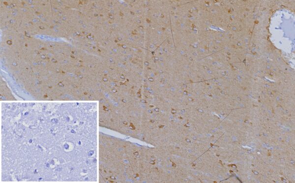 CXCR5 Antibody in Immunohistochemistry (IHC (P))