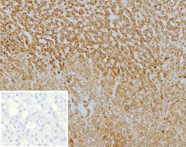 CXCR5 Antibody in Immunohistochemistry (IHC (P))