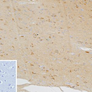 CXCR5 Antibody in Immunohistochemistry (IHC (P))