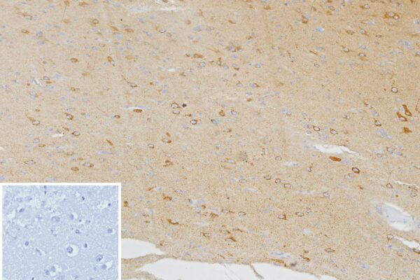 CXCR5 Antibody in Immunohistochemistry (IHC (P))