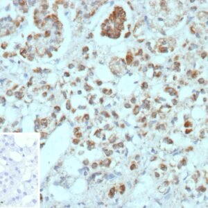 CXCR5 Antibody in Immunohistochemistry (IHC (P))