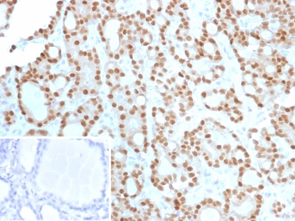 Cyclin D1 Antibody in Immunohistochemistry (IHC (P))