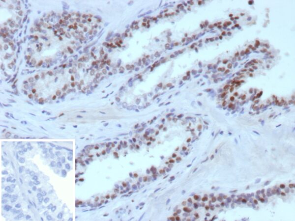 ERG Antibody in Immunohistochemistry (IHC (P))