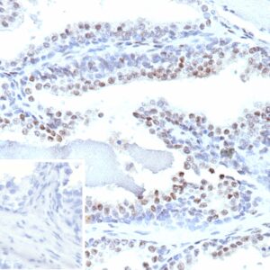 ERG Antibody in Immunohistochemistry (IHC (P))